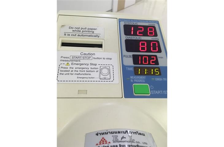 Non-invasive automatic blood pressure measurement NIBP life test device