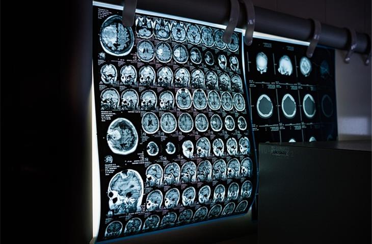 Nuclear magnetic resonance phantom