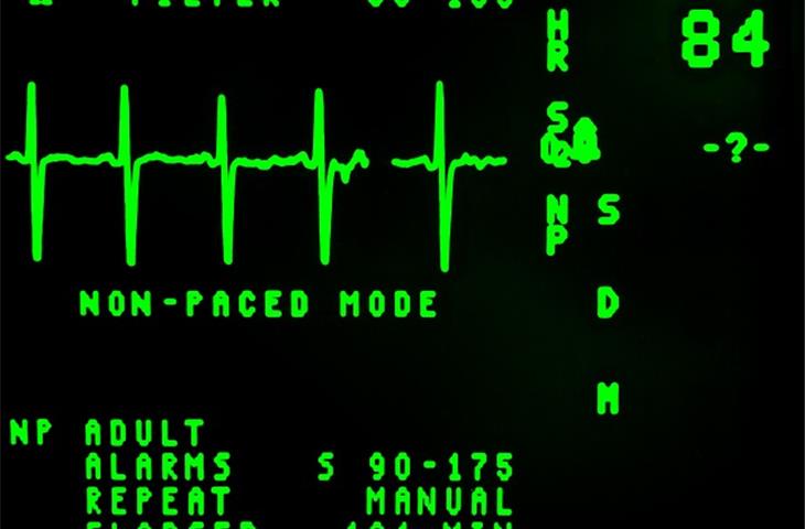 ECG electrode performance tester