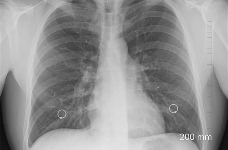 KP0029-01 rigid simulated lung